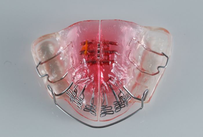 DNA-Appliance-e1412437746337-1024x694