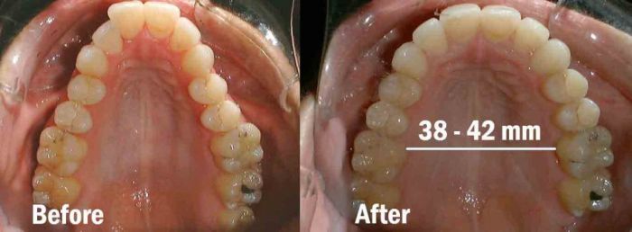 Arch-Before-and-After2-1024x378