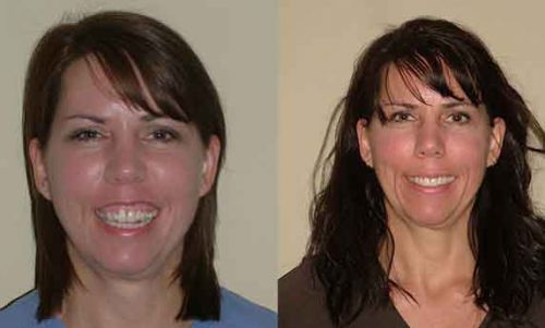cosmetic-before-after1